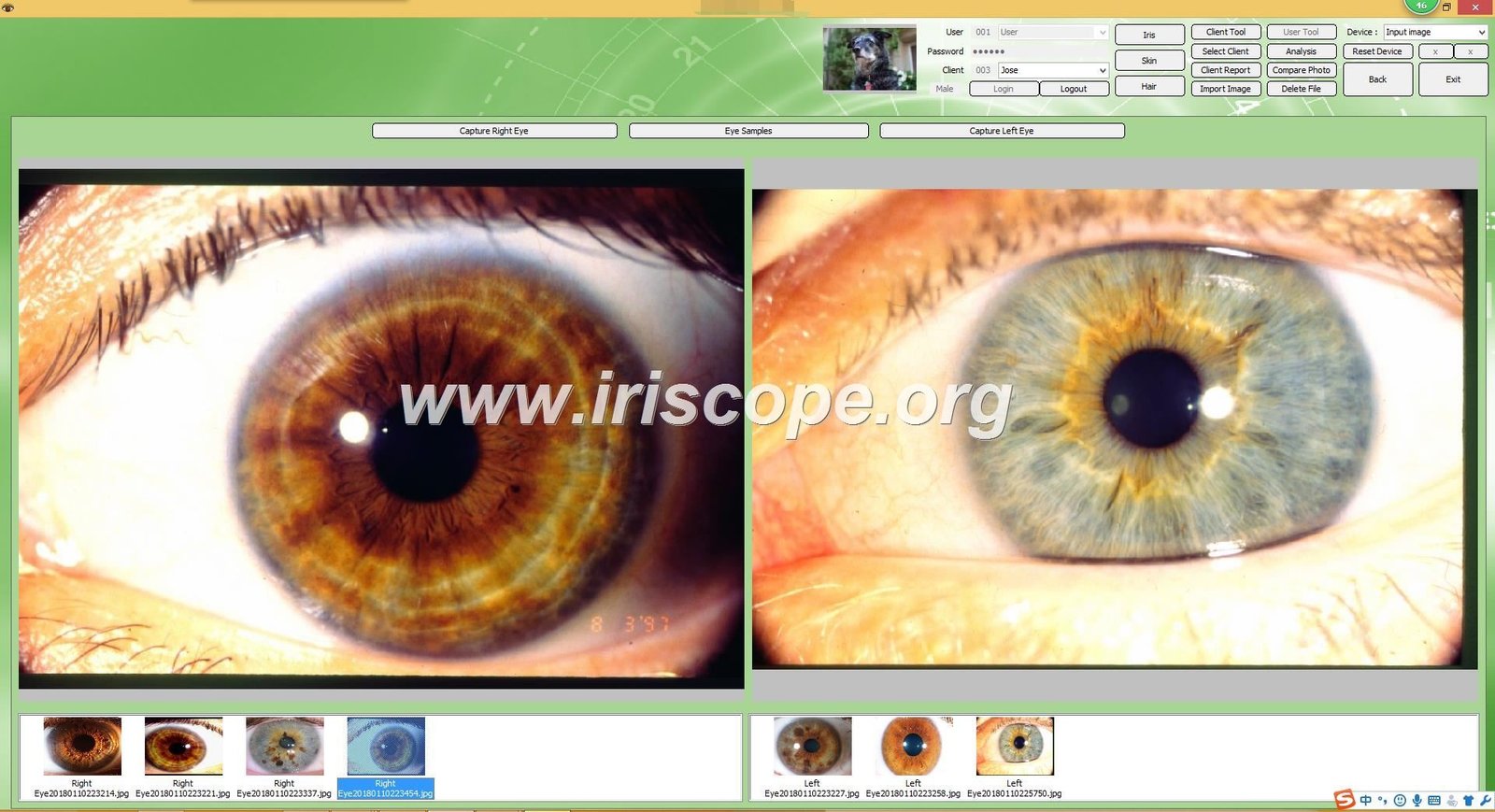 Iridology Software 14