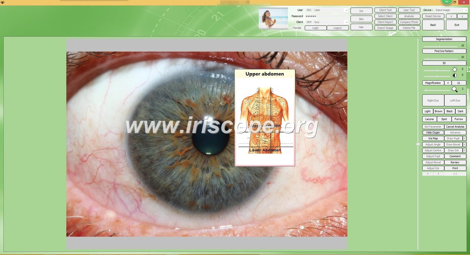 Iridology Software 40