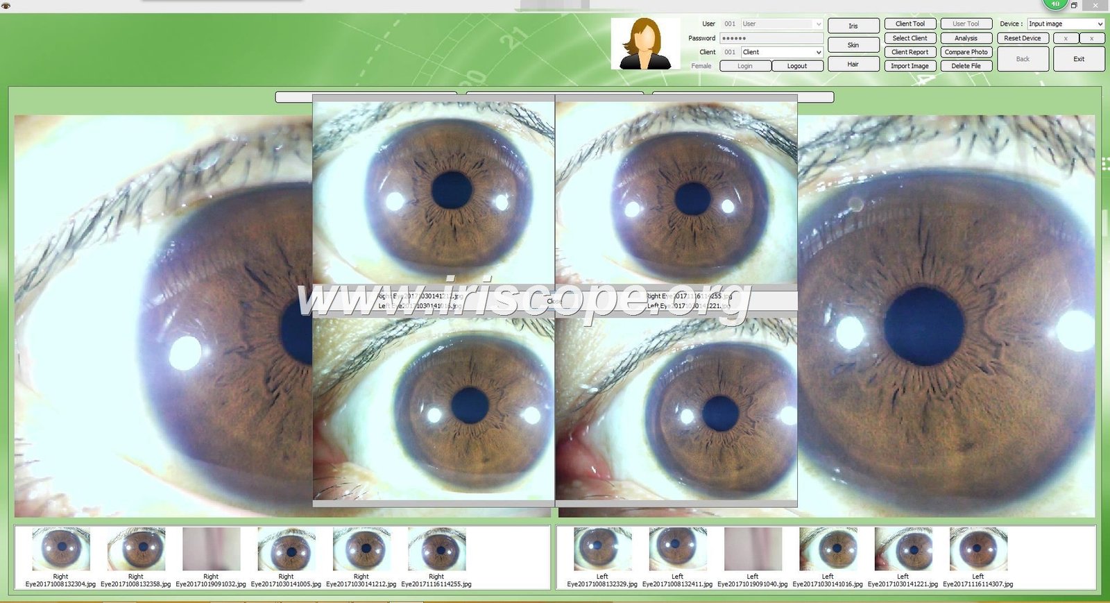 Iridology software for mac