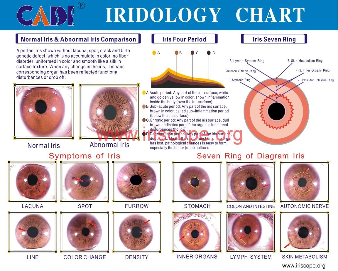 MAIKONG Iridology chart right eye