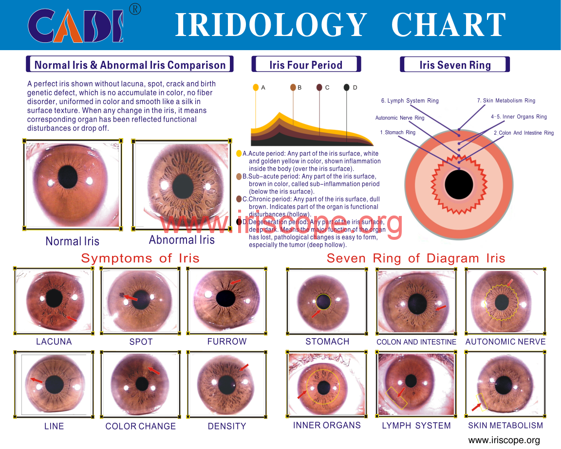 What is iridology chart