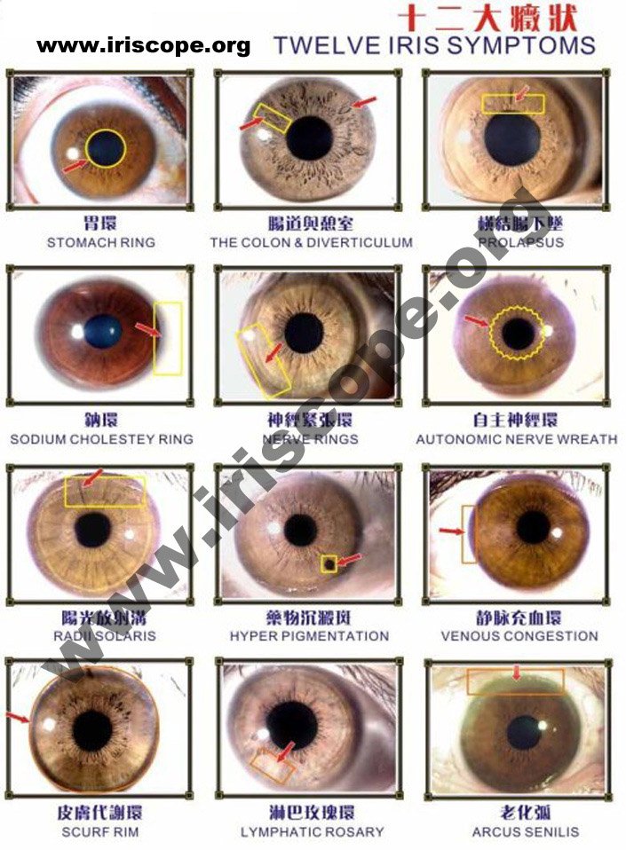 How to read iris eye iris health indicator what is iridology chart