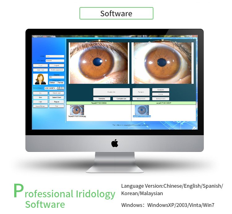 iridology camera uk