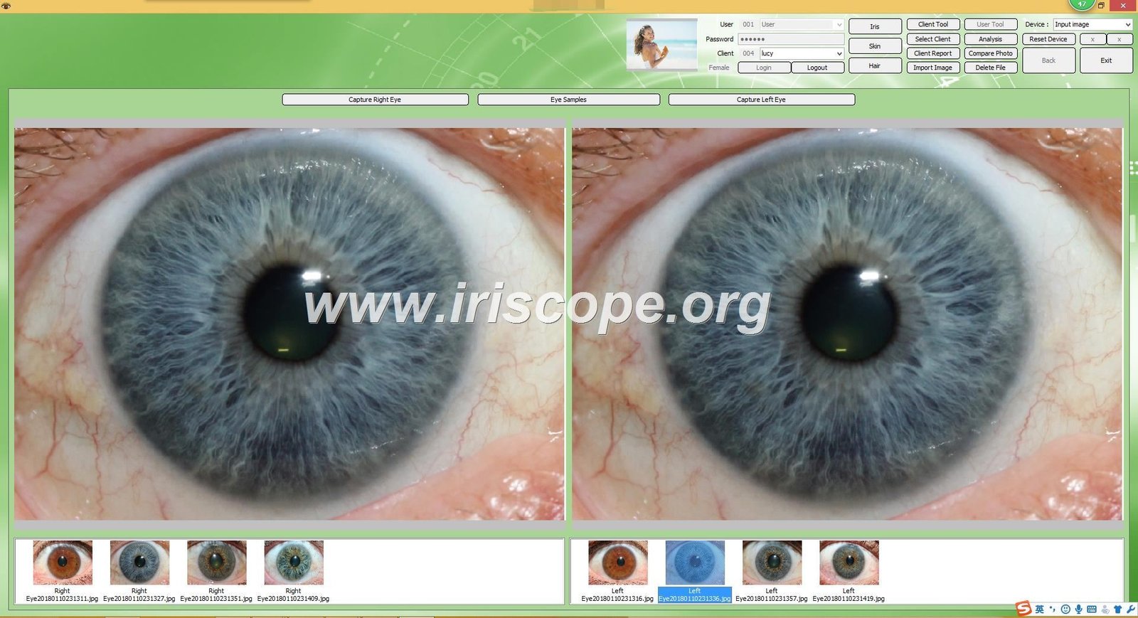 Iridology Camera Lens