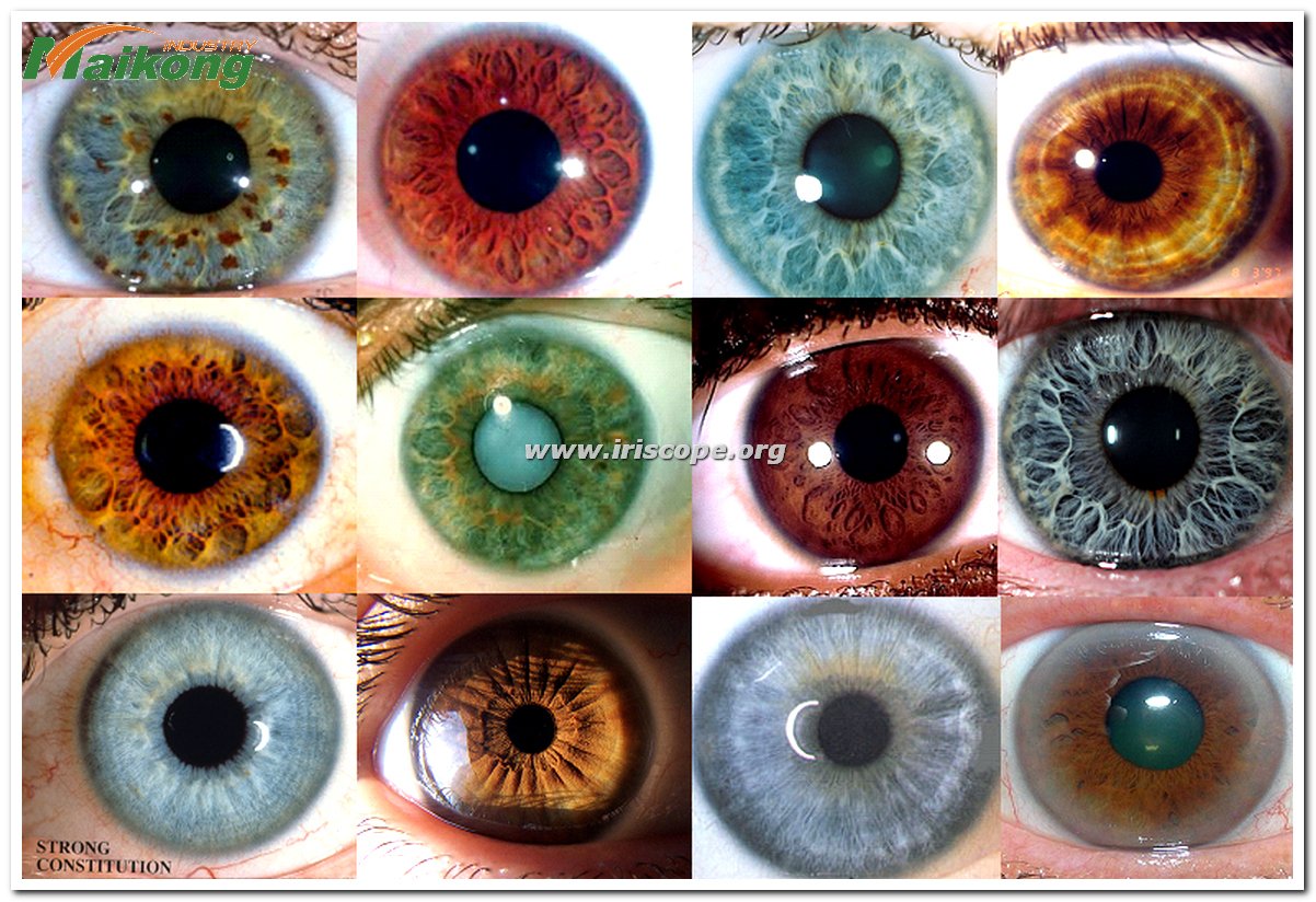 How to Read an Iridology Chart?