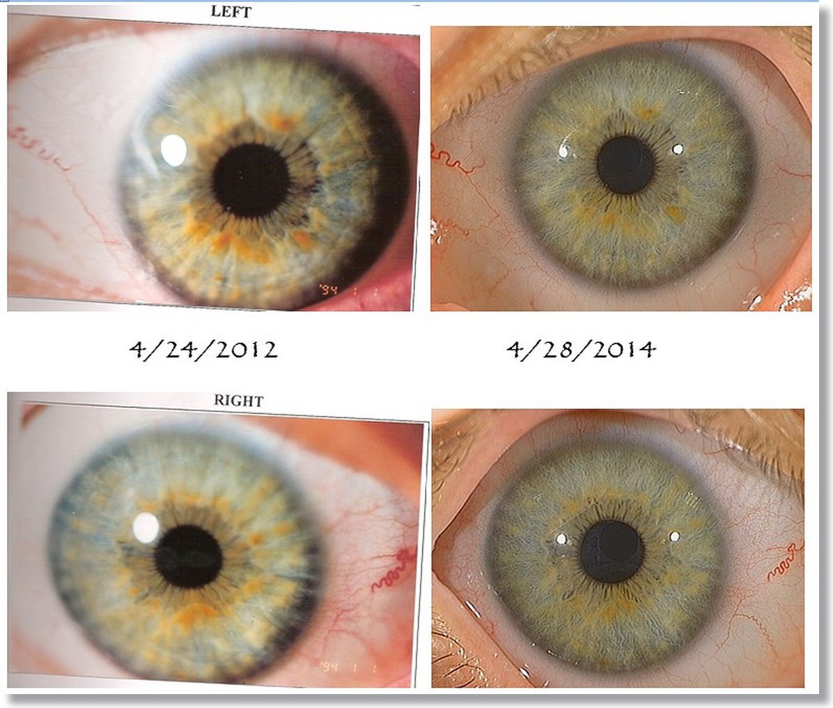 how to read your eyes